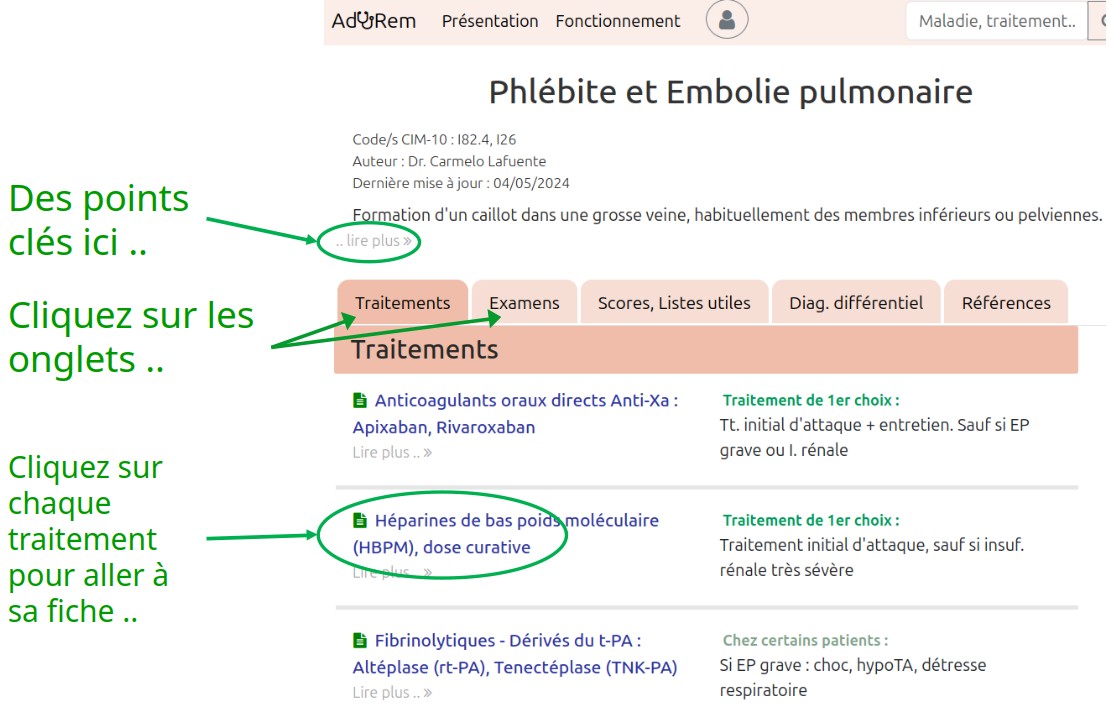 Image : Contenu des fiches, onglets